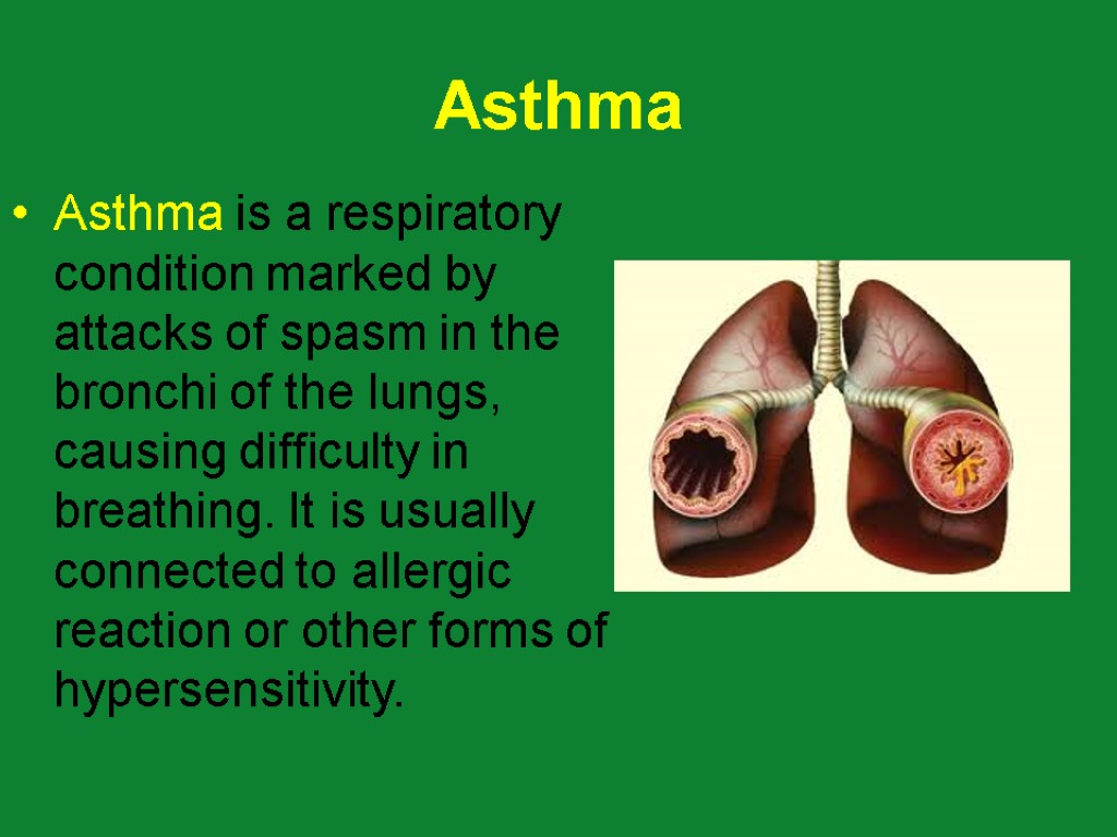 Asthma Asthma is a respiratory condition marked by attacks of spasm in the bronchi